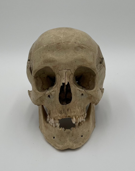 Antique Real Human Skull 580 – 6 Brains