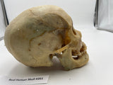 A Real Uncut Human Skull With Uncut Calvarium #261