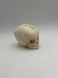 3 Month Old Pediatric / Fetal Skull