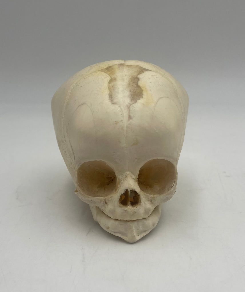 3 Month Old Pediatric / Fetal Skull