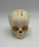 3 Month Old Pediatric / Fetal Skull