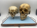 An Unusual Real Pediatric and Adult Skull Mounted Science Display