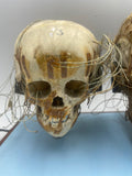 An Unusual Real Pediatric and Adult Skull Mounted Science Display