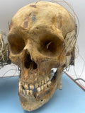 An Unusual Real Pediatric and Adult Skull Mounted Science Display