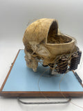 An Unusual Real Pediatric and Adult Skull Mounted Science Display