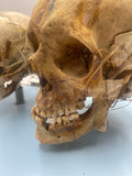 An Unusual Real Pediatric and Adult Skull Mounted Science Display