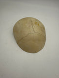 A Real Human Skull Cap 2