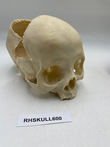 A Partial Real Human Partial Skull 600