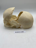 A Partial Real Human Partial Skull 600