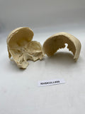 A Partial Real Human Partial Skull 600