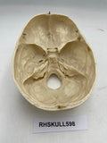 A Partial Pediatric Human Skull 598