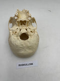 A Partial Pediatric Human Skull 598