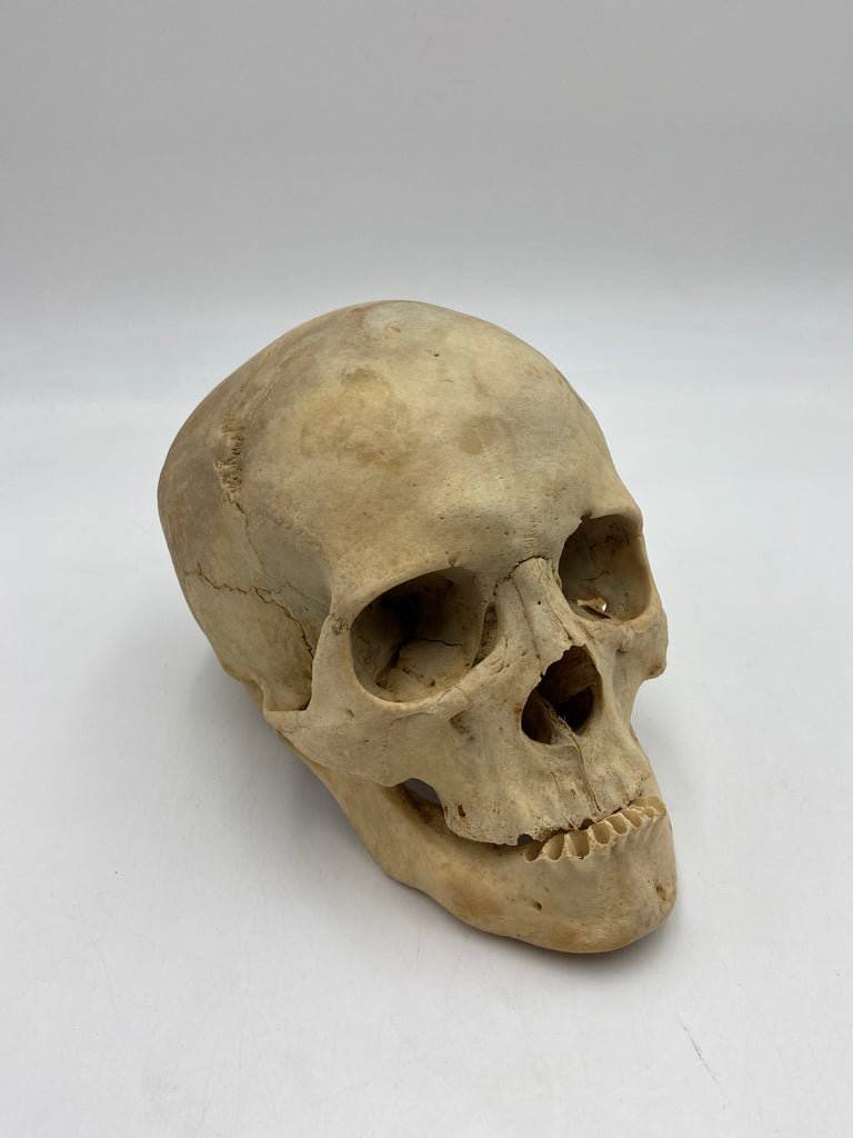 A Uncut Real Human Skull #59