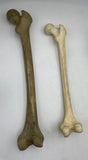 A Female and Male Real Human Femur Set #300