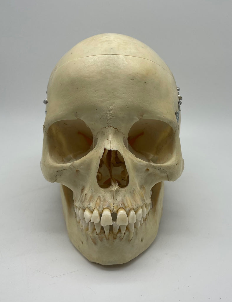 Adolescent Skull with Real Dentition Immaculate Genuine Human Skull