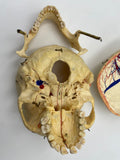 A Vintage Real Human Dissected Skull 202