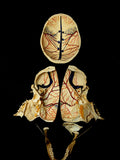 Dissected Human Skull