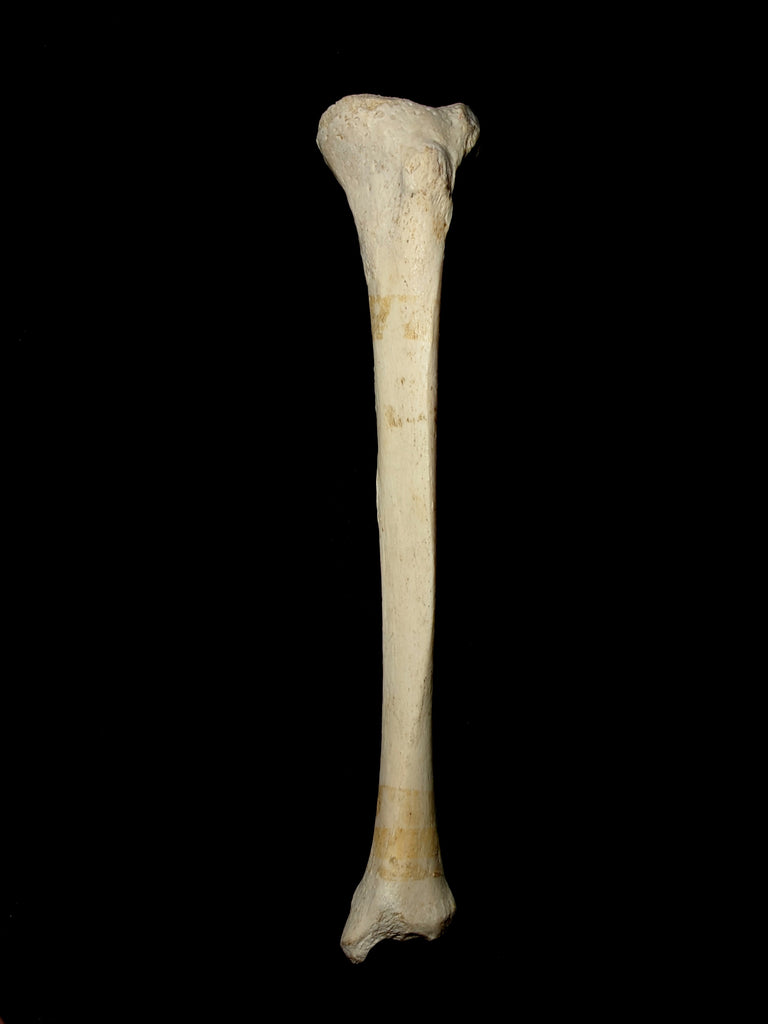 Tibia And Fibula Unlabeled