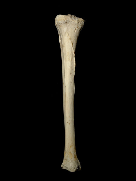 Human Tibia