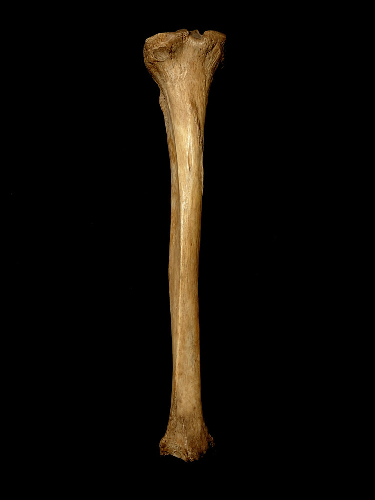 Ladder Tibia Human Tibia