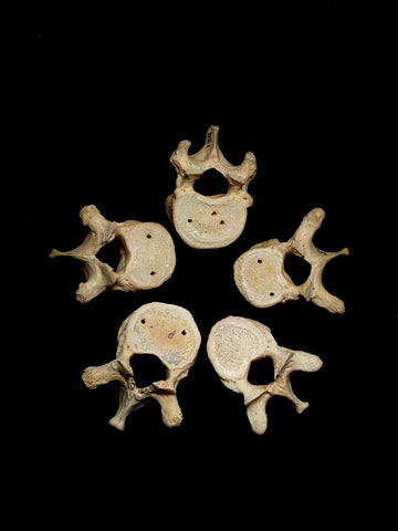 Adult Articulated Human Torso With Spina Bifida Occulta – 6 Brains