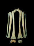 Young Pediatric Human Leg Bone Set
