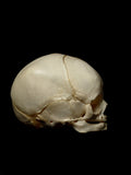 30 Week Old Human Fetal Skull